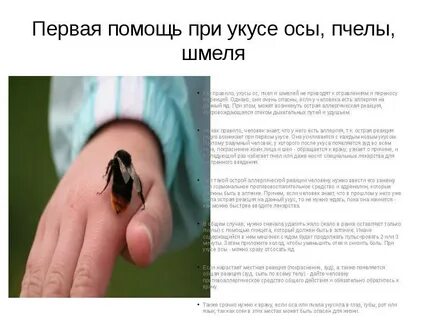 Если укусила оса что нужно