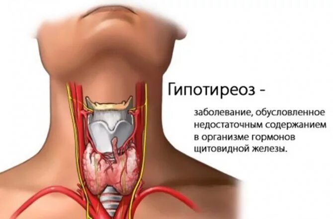Можно ли вылечить щитовидку