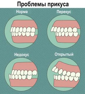 Игра правильные зубы