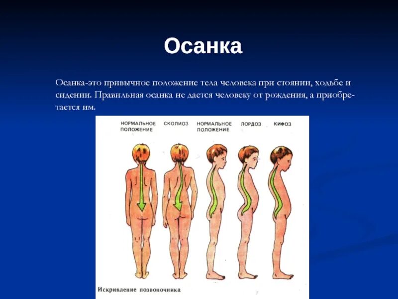 Осанка человека. Осанка это определение. Осанка тела человека. Осанка презентация.