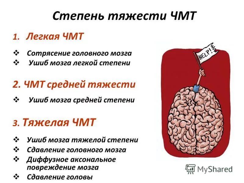 Сотрясение 2 степени