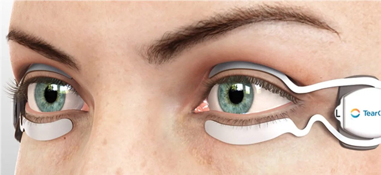 Eye go. Vision dry eye. dry eye evaluation &amp; treatment. tearcare.