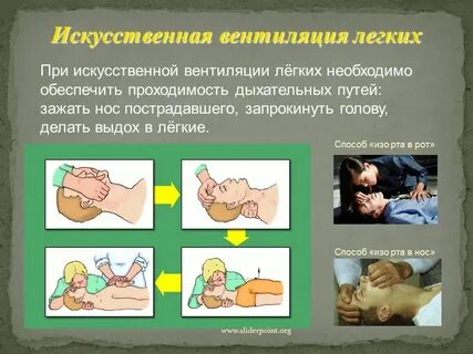 Искусственное дыхание проводится в случаях