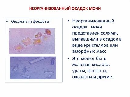 Моча кристаллы выше нормы