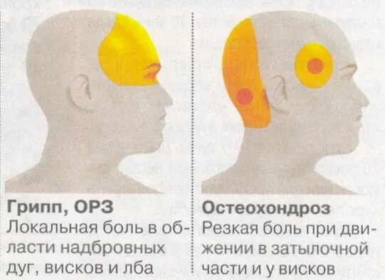 Области головной боли. Причины головной боли. Затылочная часть головы. Болит затылочная часть головы причины.