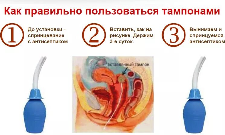 Как пользоваться томпон. Как пользоватьсяьампонами. УАК пользоваться тампон. Как пользоваться тампонами.