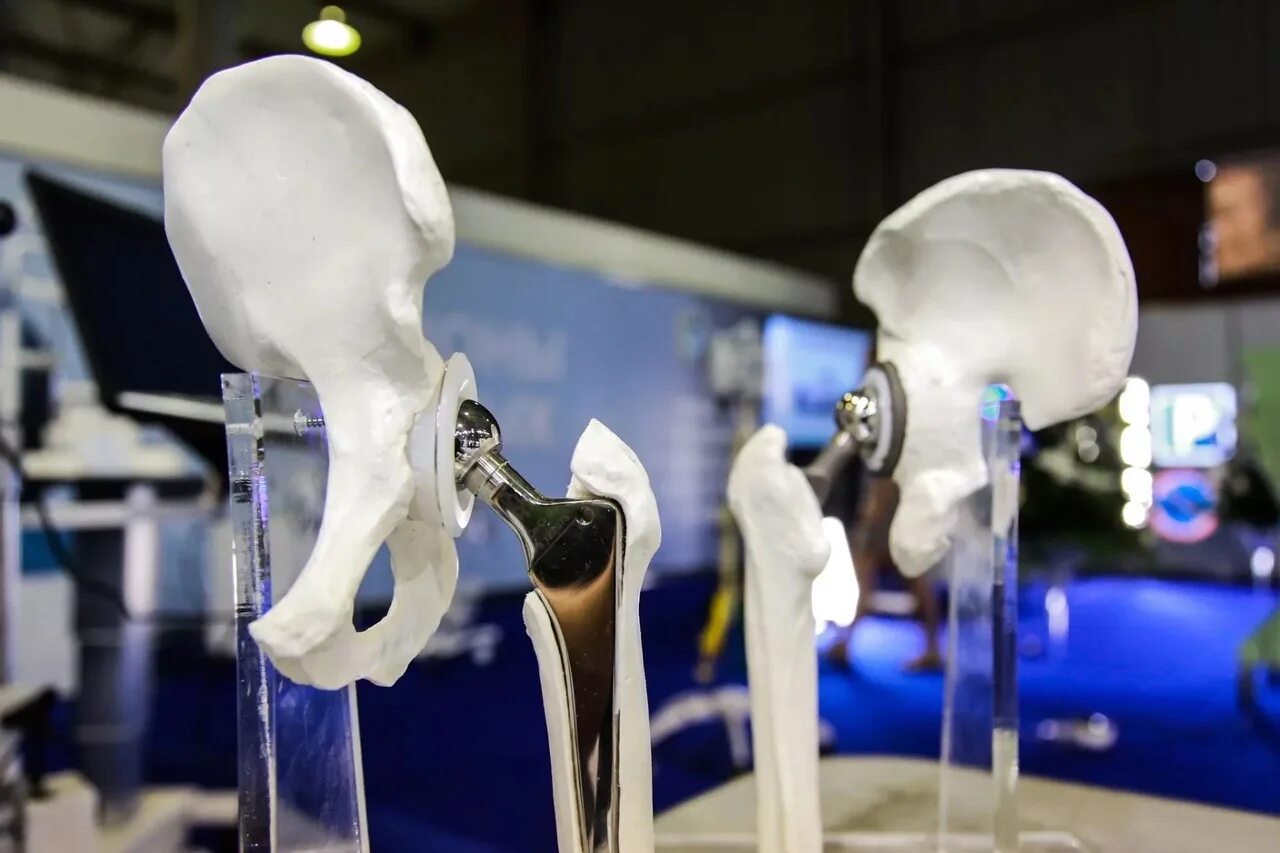 Протез кости. Коленный эндопротез depuy. эндопротез титан. эндопротез тазобедренный титан керамика. титановый эндопротез коленный.