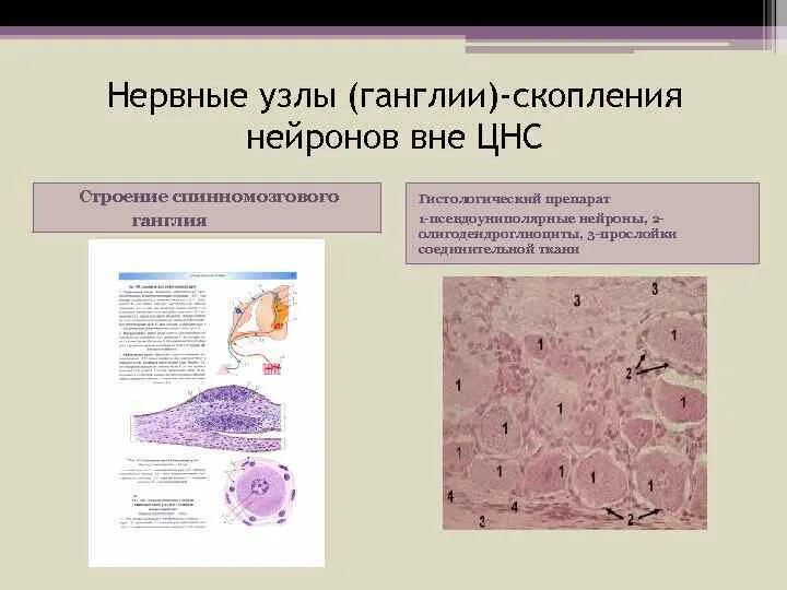 Спинномозговой ганглий гистология. Псевдоуниполярные Нейроны препарат. Псевдоуниполярные Нейроны препарат. Спинномозговой ганглий. Псевдоуниполярные Нейроны гистология препарат.