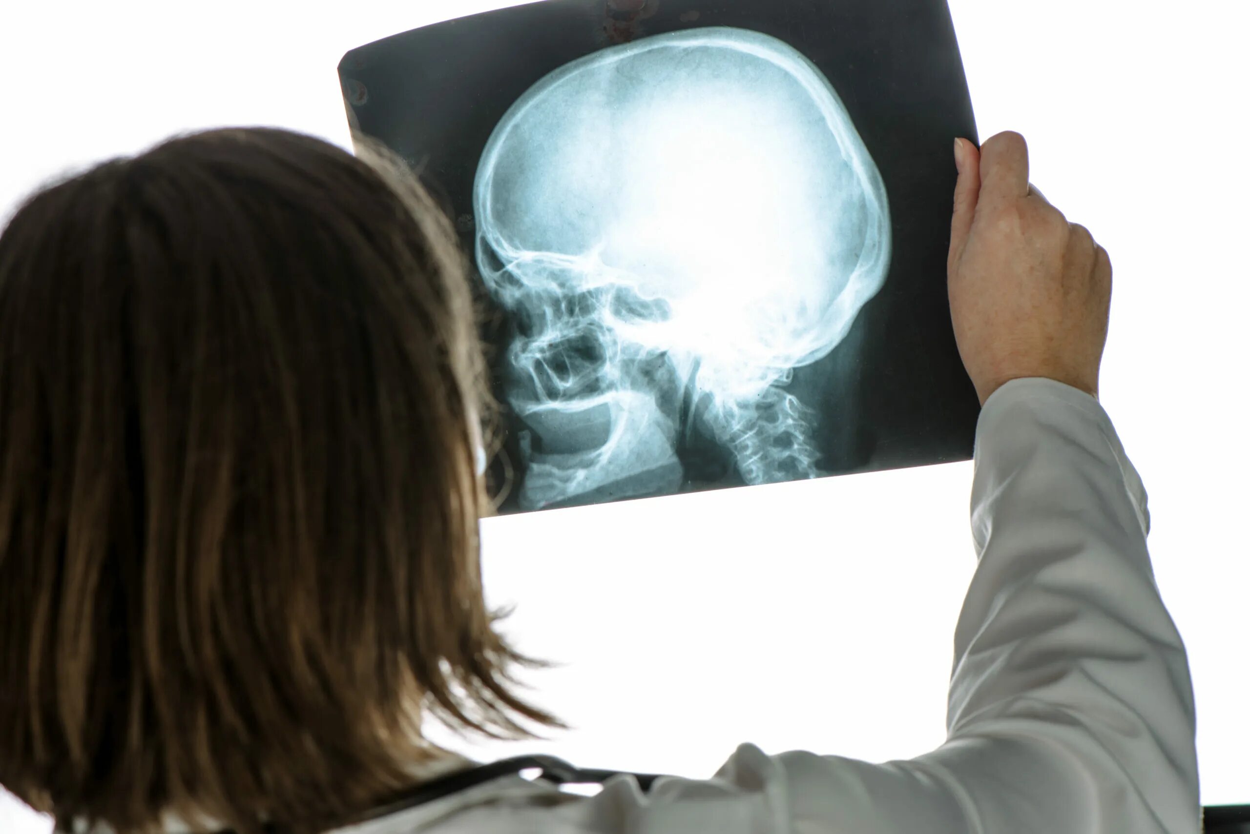Сотрясение врач. Рентгенография головы. Рентгеновский снимок головы.