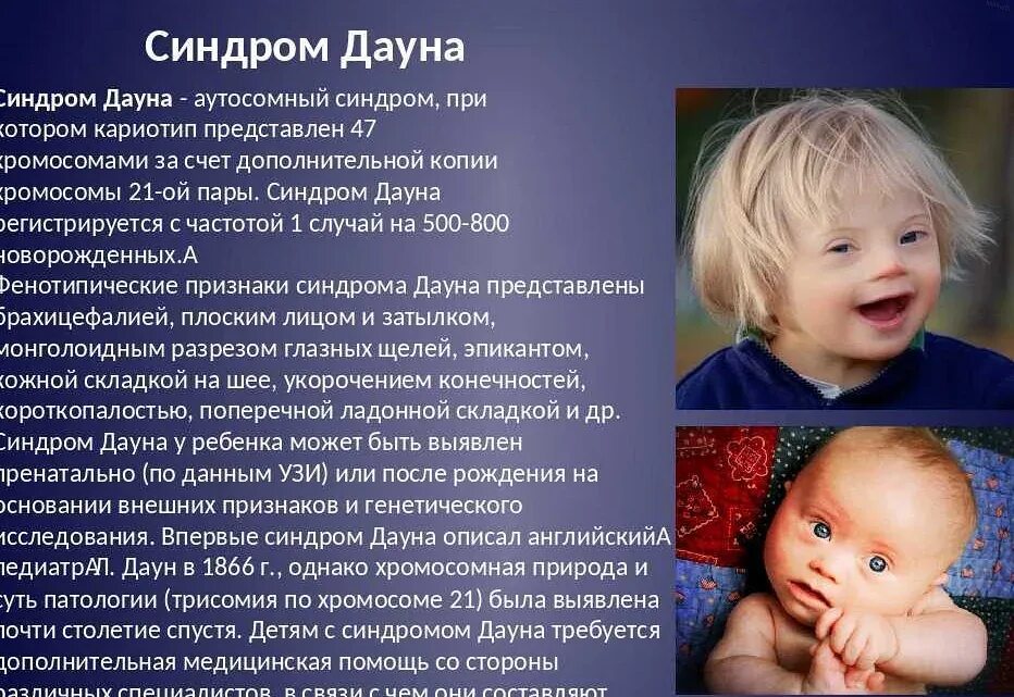 Характер проявления синдрома дауна. Синдром дауна. Почему люди с синдромом дауна. Болезнь дауна характеристика. Почему люди с синдромом дауна.