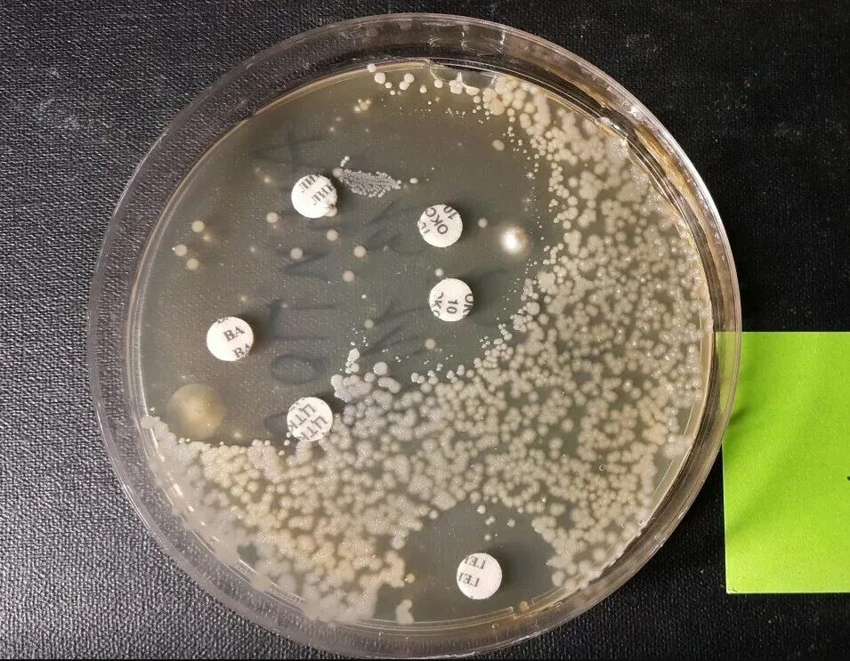 Бактерии бак. Чашка Петри антибиотикорезистентность. Бак посевы на чашках Петри. Чашка Петри с питательной средой. Микробиологическое исследование мочи на микрофлору.
