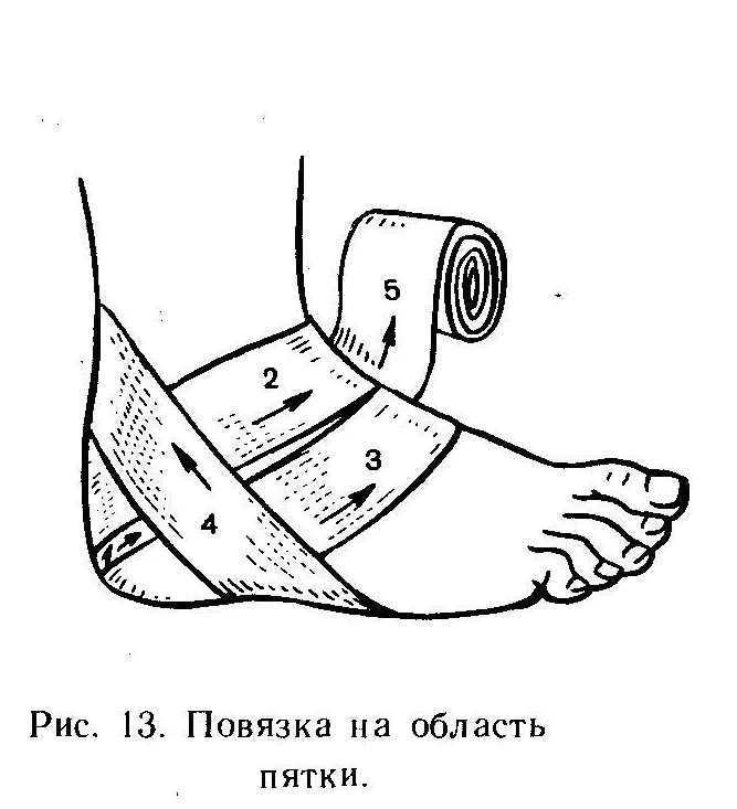 Десмургия восьмиобразная повязка. Десмургия черепашья повязка. Перевязка голеностопа эластичным бинтом. Алгоритм черепашьей повязки на пяточную поверхность. Наложение эластичного бинта на конечность