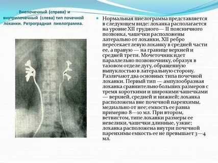 Слева лоханка