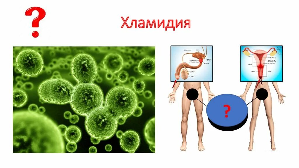 Хламидии песня слушать