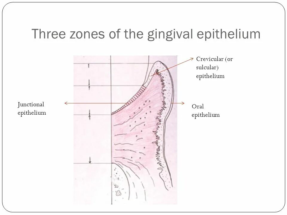 Three zones. Three zones