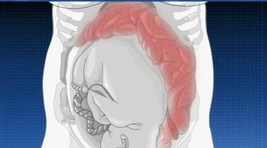 Сильная боль в матке. Кишечник в 3 триместре беременности. Запор у беременной. Кишечник и беременность. Кишки при беременности.