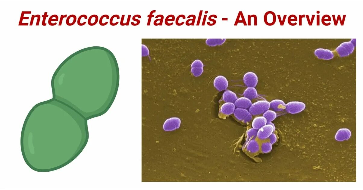Enterococcus 10 в 5