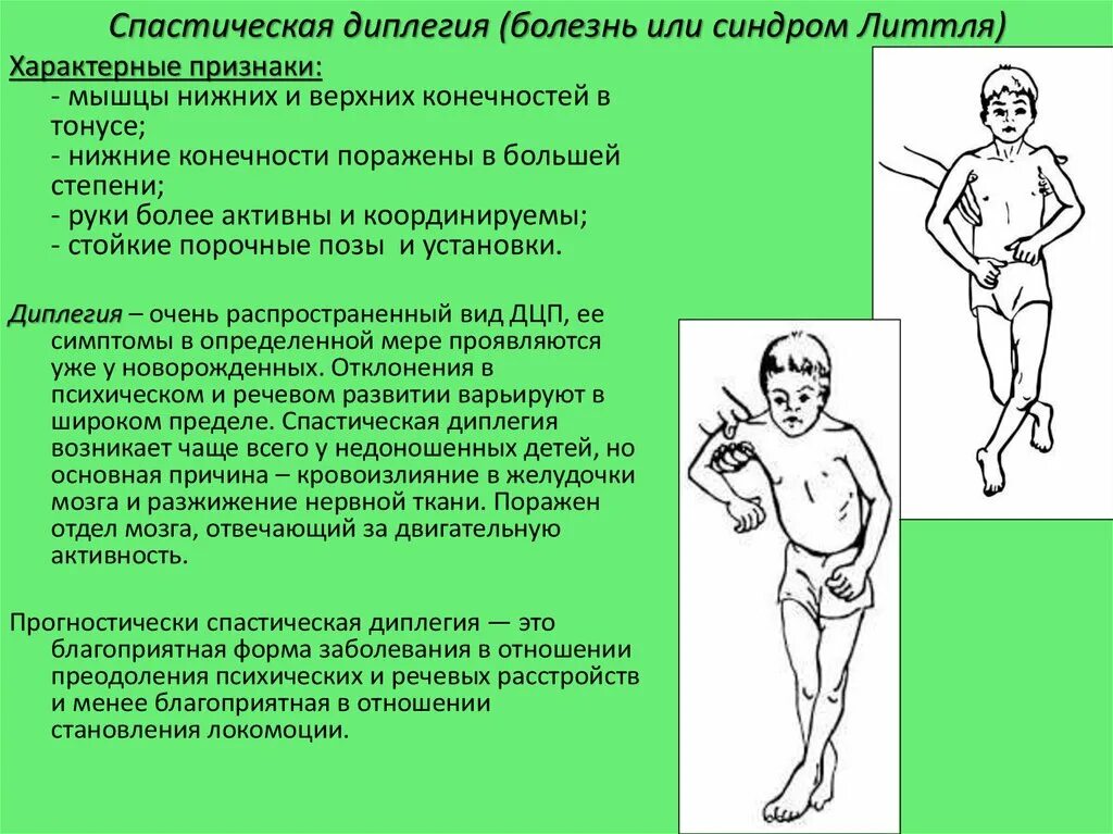 Дцп диплегия. Спастическая диплегия легкой степени тяжести. Диплегия форма ДЦП. ДЦП спастическая диплегия симптомы. Спастическая диплегия форма ДЦП.