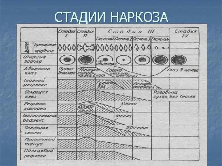 Стадии наркоза. Стадии наркоза