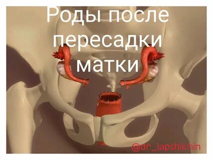 Матка у мужчин