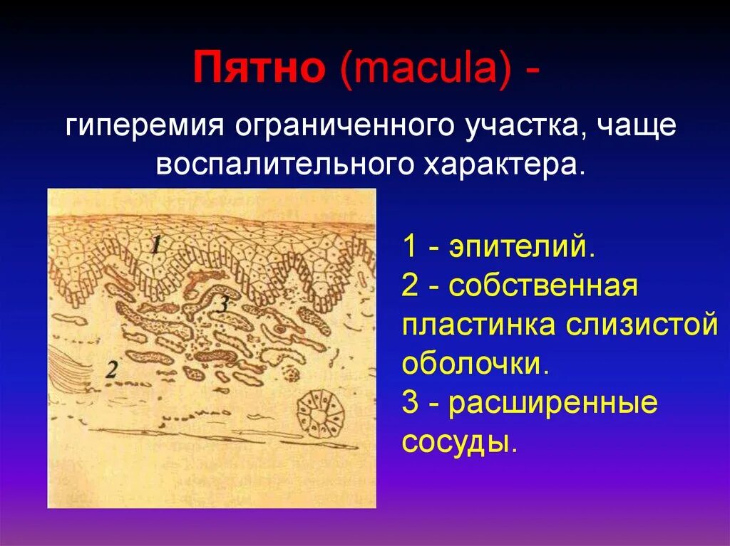 Вторичные элементы поражения. Пятна воспалительного характера. Первичные элементы поражения слизистой оболочки полости рта пятно. Собственная пластинка слизистой оболочки полости рта.