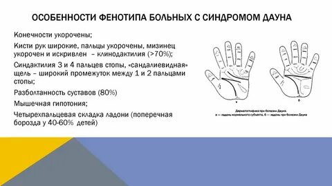 Синдром ладони