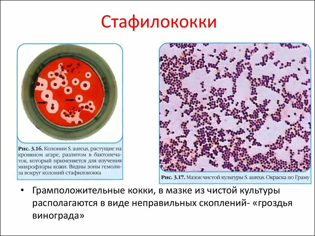 Грамположительные кокки микробиология. Грамположительные кокки. Стафилококки.. Патогенные кокки. Грамположительные кокки. Чистая культура стафилококка ауреус. Стафилакока