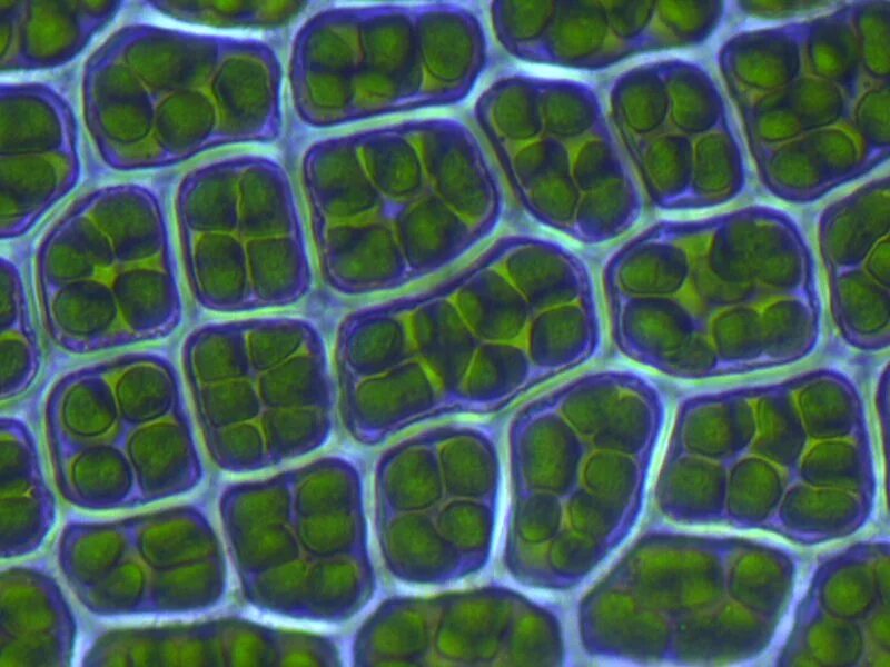 Паренхимные клетки растений. Клетки листа мха мниума препарат. Паренхимные и прозенхимные клетки листа мха мниум. Клетки листа мха мния остроконечного. Сильно вытянутые клетки