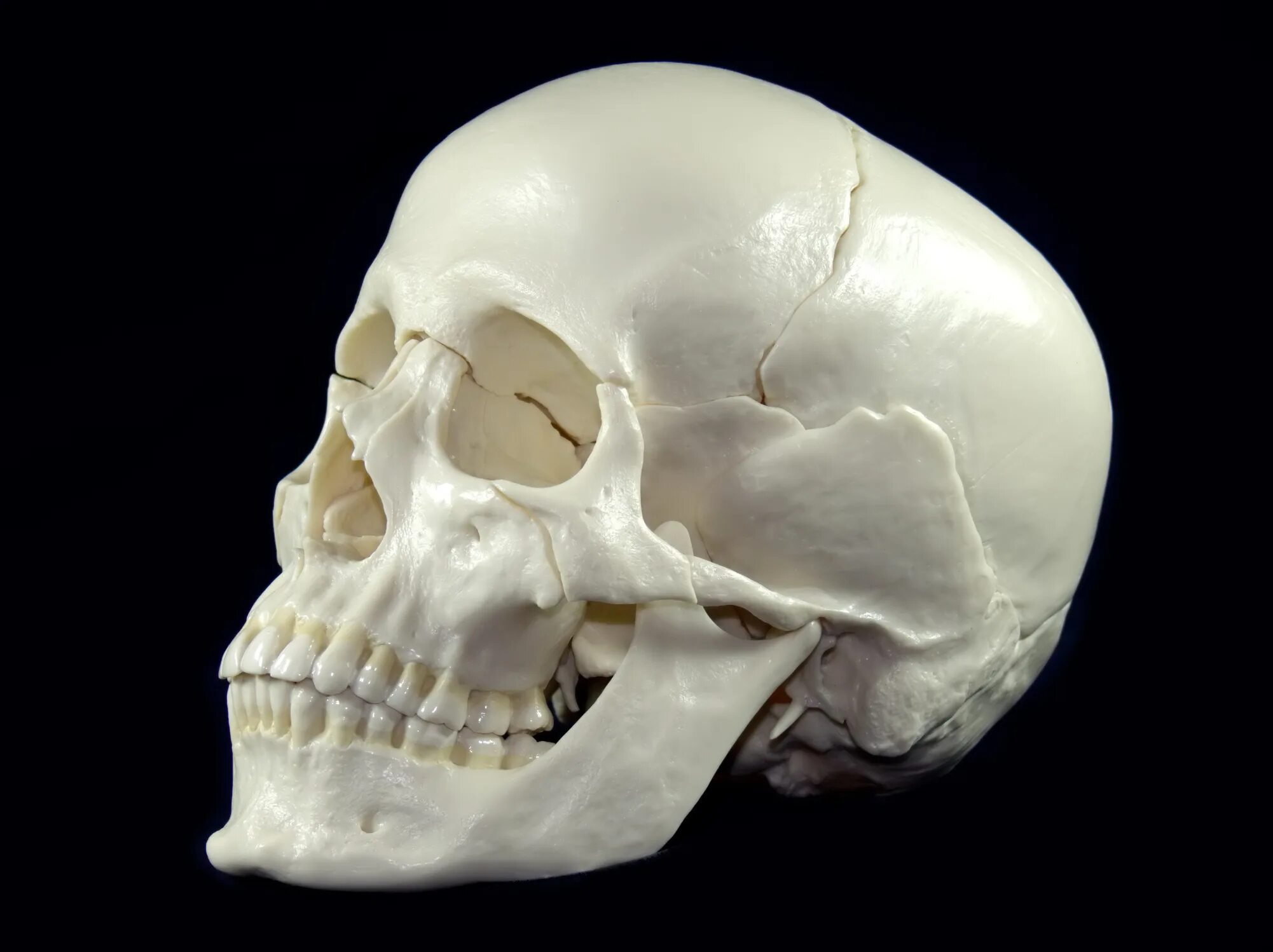 Черепная аномалия. Снимок патологии черепа. Патологии черепа головы.