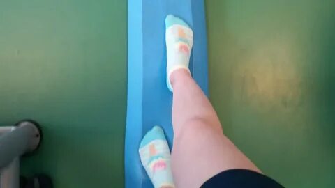 Видео переломы со смещением