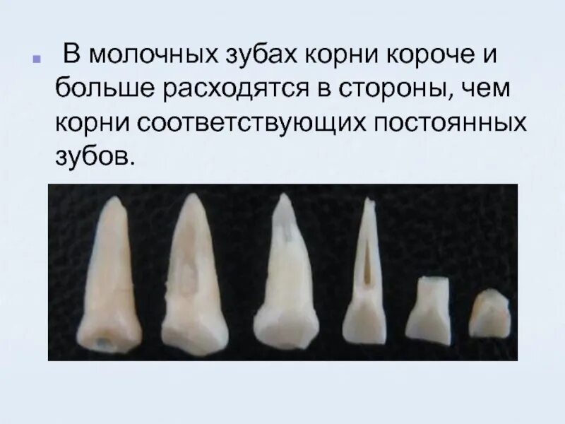 Молочные зубы выпадают без корня: найдено 90 картинок