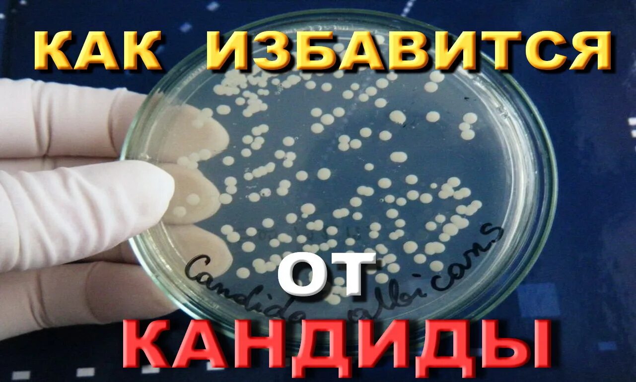 Как избавиться от грибка кандида. Колонии кандида альбиканс. Как избавиться от грибка в организме. Грибковая инвазия кандида. Грибок кандида под микроскопом.