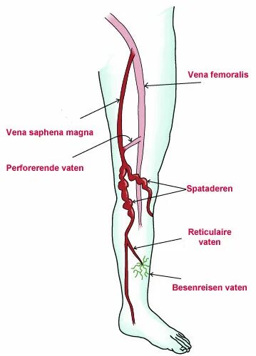 Vena saphena. V saphena Magna. Vena saphena Magna.