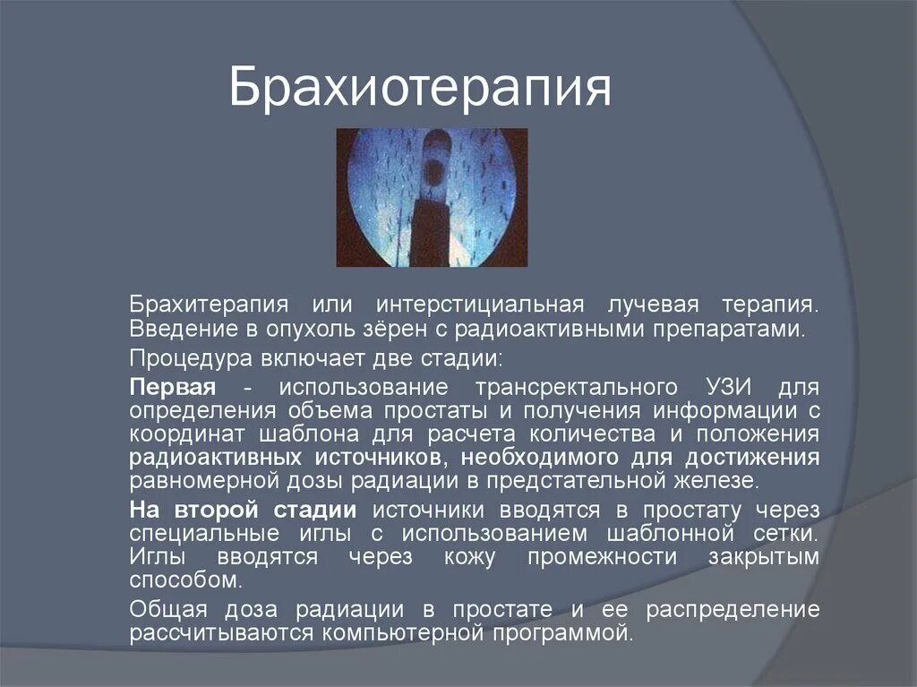 Рецидивы после лучевой терапии. Контактная лучевая терапия брахитерапия это. Дучевая тераптяпредстательной железы. Внутритканевая лучевая терапия. Лучевая терапия предстательной железы.