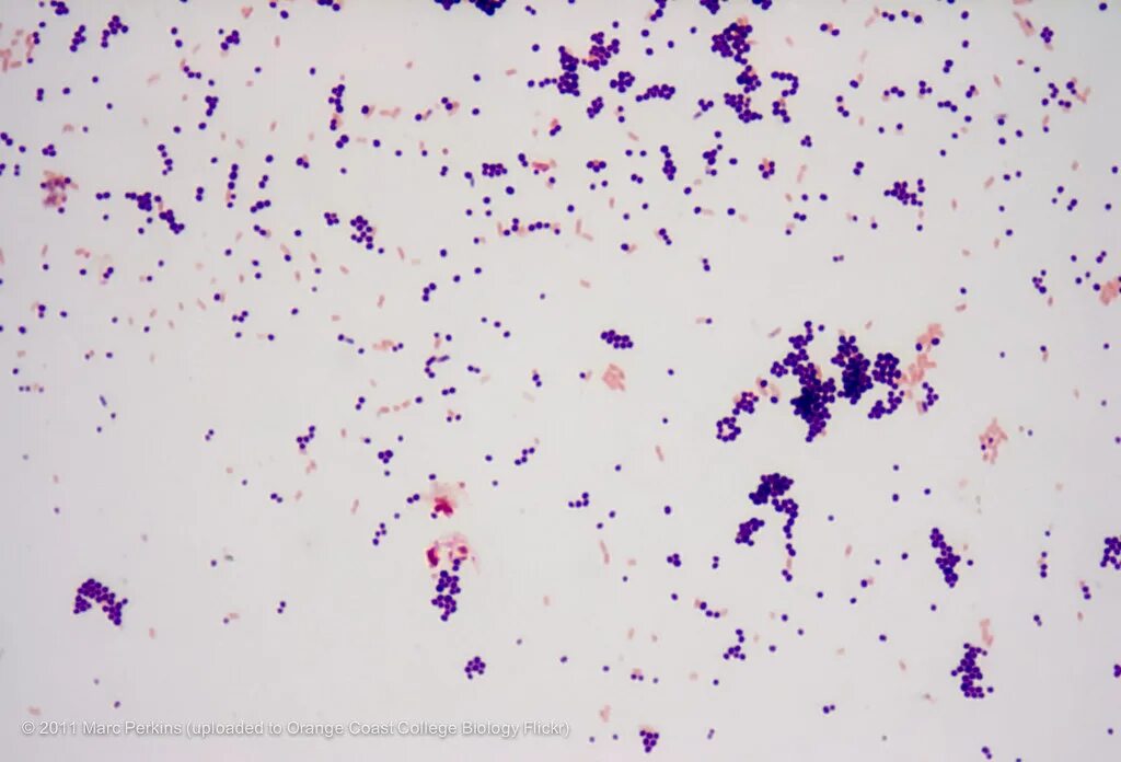 Streptococcus в мазке у мужчин. Стафилококки генцианвиолет. S.aureus микроскопия. Стафилококкус ауреус микроскопия.