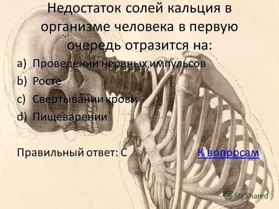 осложнения дефицита кальция. недостаток солей кальция. роль кальция в организме человека. недостаток кальция в организме. соли кальция в организме.