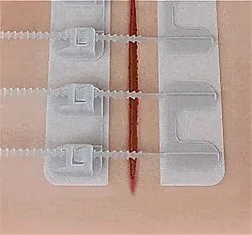 Zipstitch