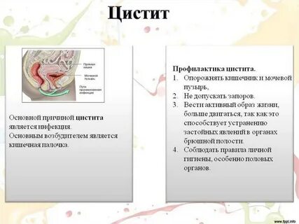 Признаки и причины цистита у женщин