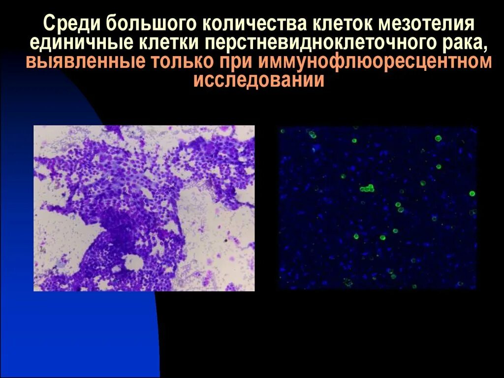 Мазок мокроты на атипичные клетки. Клетка это в биологии определение. Единичные клетки что это. Единичные клетки что это. Цилиндрический эпителий шейка матки.