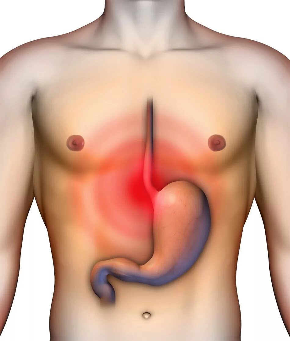 Боль в эпигастрии и отрыжка
