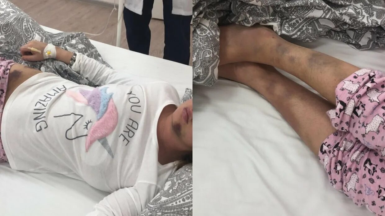 Состояние девочки после. Мария высоцкая дочь юлии высоцкой. Девушка в реанимации в коме. Максим певица состояние здоровья. Состояние девочки после.