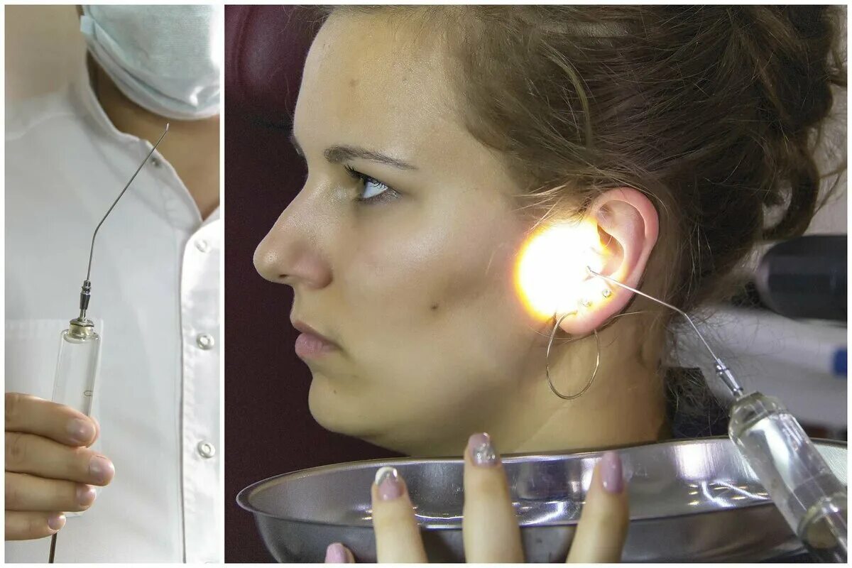 Строение уха евстахиева труба. Серная пробка отоскопия. Острый катаральный средний отит лечение. Лор ухо. Рефлектор минина.