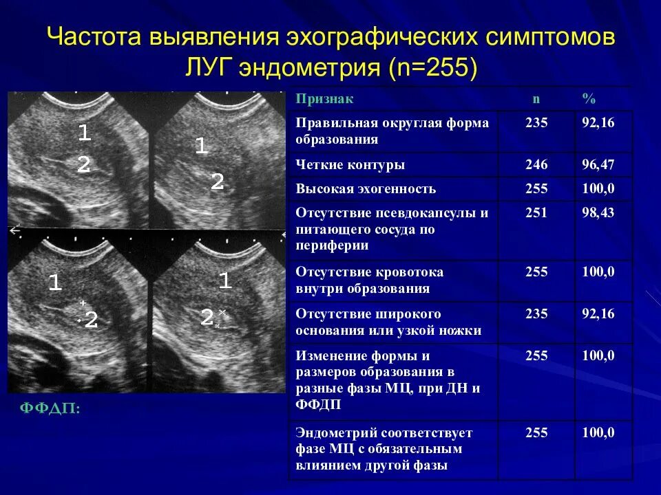 Эндометрия 7 5. Структура эндометрия на УЗИ. Структура эндометрия неоднородная. Фазы эндометрия по УЗИ.