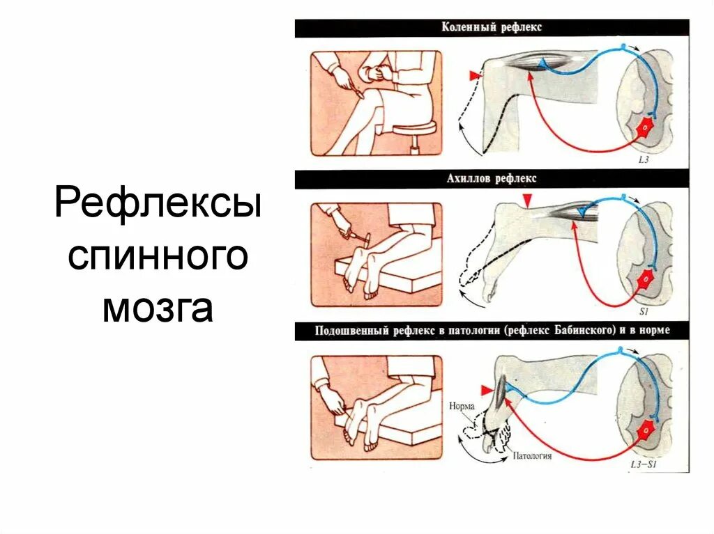 Рефлексы верхних конечностей. Схема рефлекторной дуги ахиллова рефлекса. Схема рефлекторной дуги ахиллова рефлекса 5. Ахиллов рефлекс дуга. Схема рефлекторной дуги ахиллова рефлекса звенья.