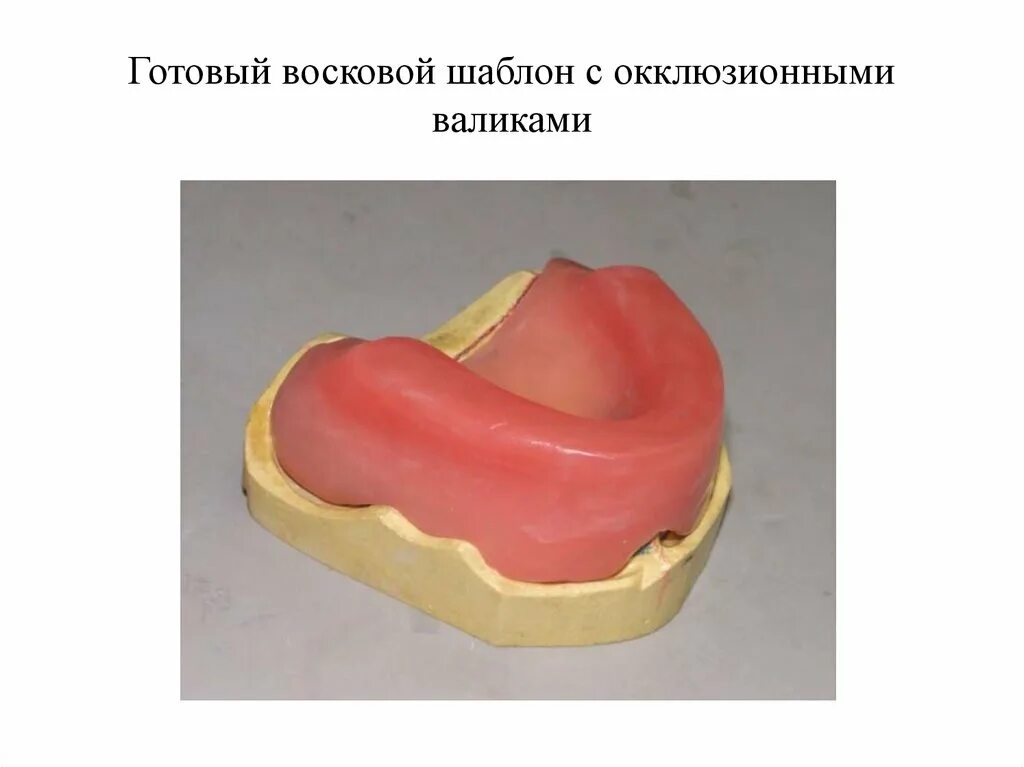 Изготовление восковых базисов. Восковой Базис с окклюзионными валиками. Восковые базисы с окклюзионными валиками из воска.. Восковой шаблон с окклюзионными валиками. Изготовление восковых базисов с окклюзионными валиками.