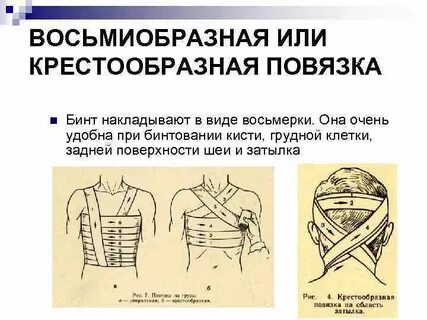 Варианты повязок