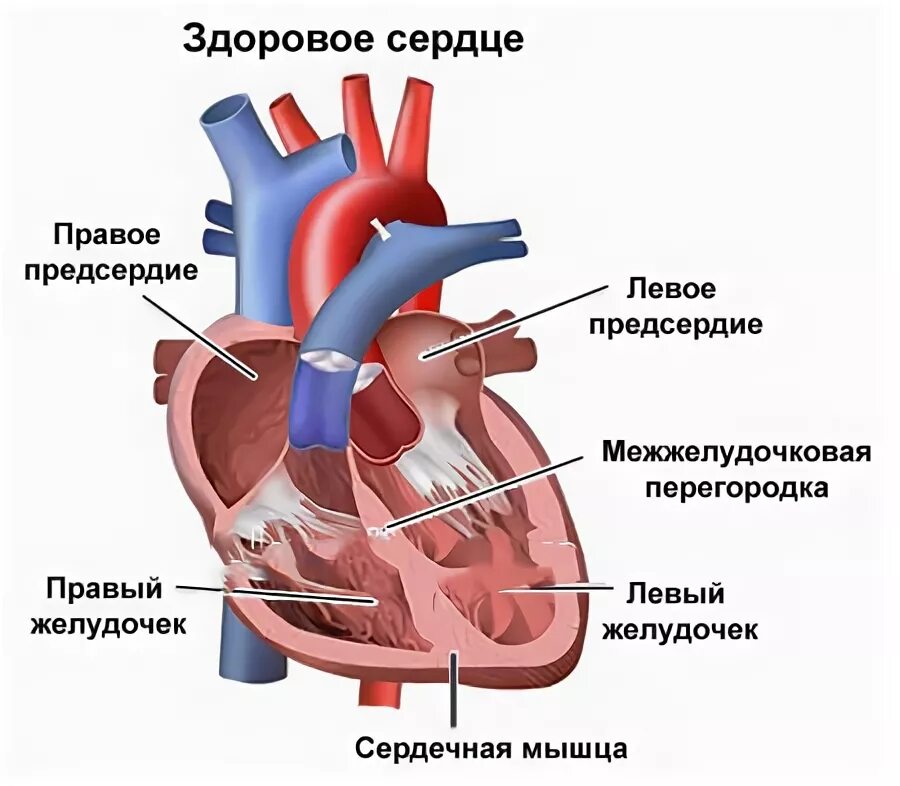Правое предсердие аорта левый желудочек легкие левое. Синдром спортивного сердца. Спортивное сердце. Сердце спортсмена отличие от здорового. Выброс крови из левого желудочка.
