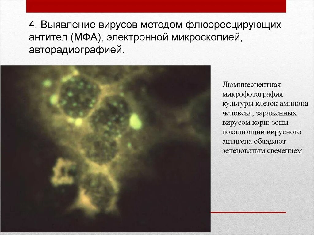 Метод люминесцентной микроскопии. Люминесцентная микроскопия вируса гриппа. МФА метод флюоресцирующих антител. Метод флюоресцирующих антител микробиология. Называют обладают флюоресцируют