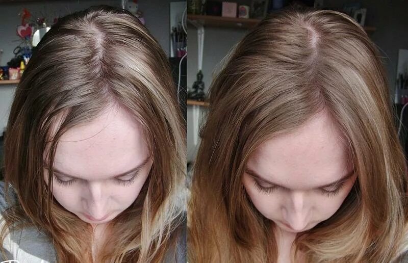 Грязные сальные волосы. Грязные волосы у девушки. Грязные волосы. Как понять что голова грязная. Как понять что голова грязная.