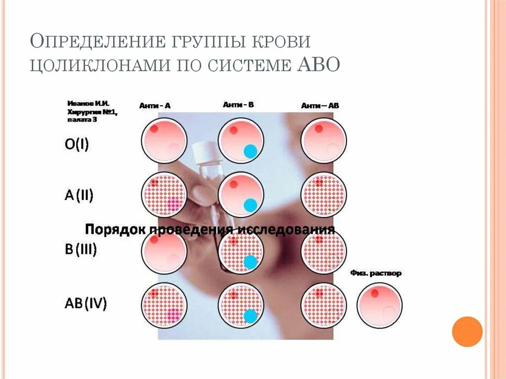 Определение группы крови и резус цоликлонами